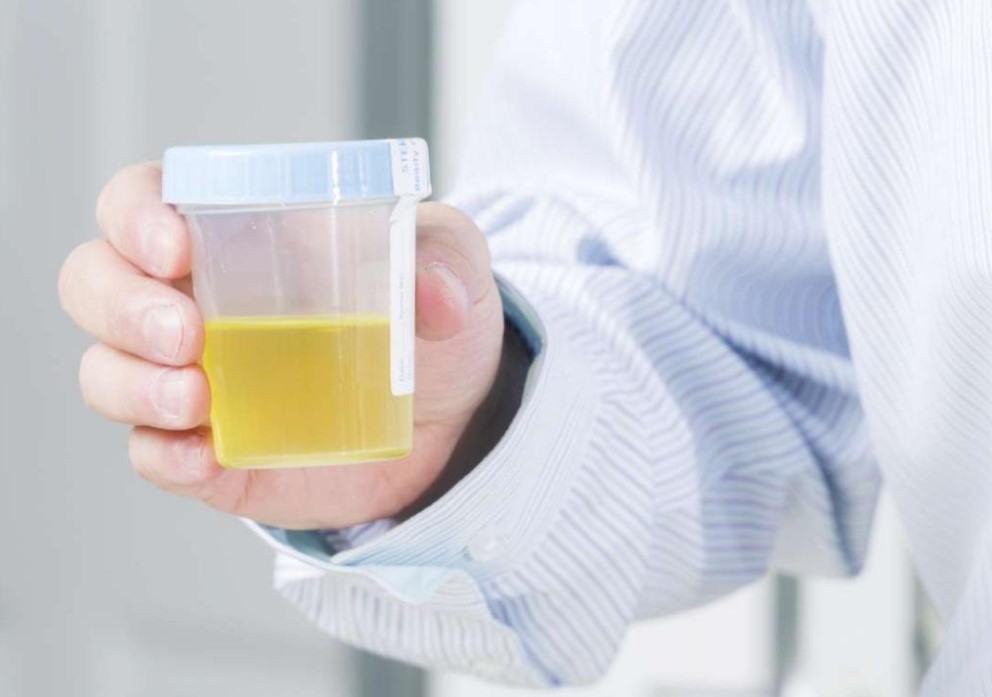 TMI POST* White particles in urine during early pregnancy (approx