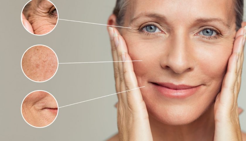 How to Take Care of Menopausal Skin