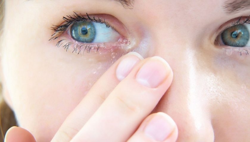 Watery Eyes